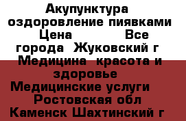 Акупунктура, оздоровление пиявками › Цена ­ 3 000 - Все города, Жуковский г. Медицина, красота и здоровье » Медицинские услуги   . Ростовская обл.,Каменск-Шахтинский г.